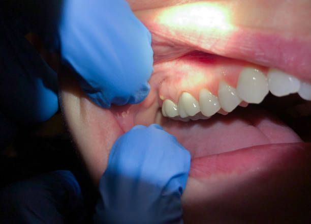  Pierce, NE Emergency Dentist Pros